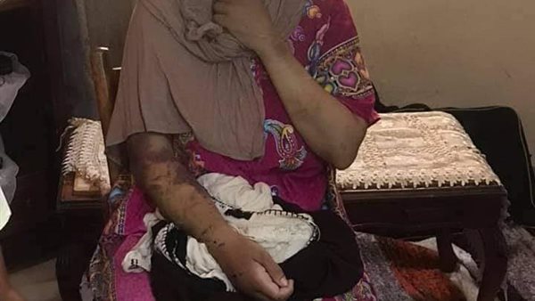 شيماء ضحية العنف