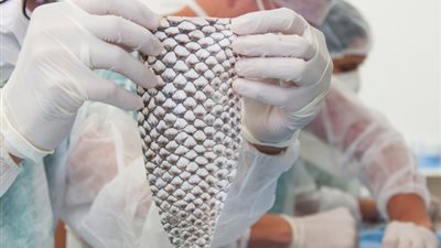 متحولة جنسيًا تحصل على مهبل من جلد السمك