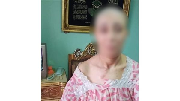 الزوجة المجني عليها