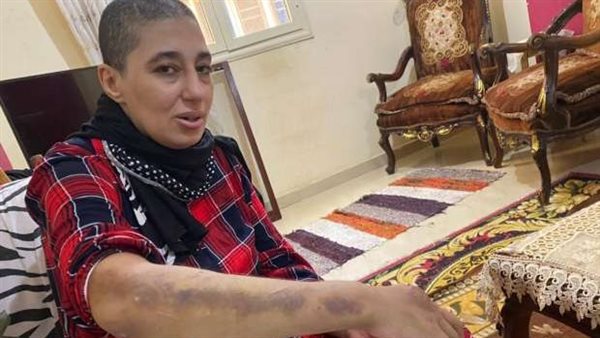 التعدي على زوجه وحلق