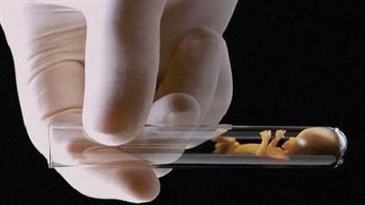 دراسة تحذر: عمليات أطفال الأنابيب تضاعف من مخاطر حدوث مضاعفات الحمل المميتة