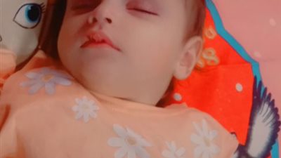 تضارب بنتائج الفحوصات.. أم تستغيث لعلاج طفلتها المصابة بضمور في العضلات (صور)