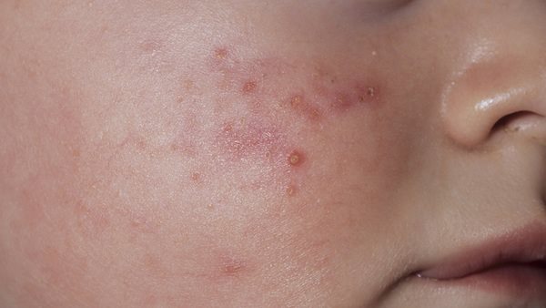 أمراض جلدية 