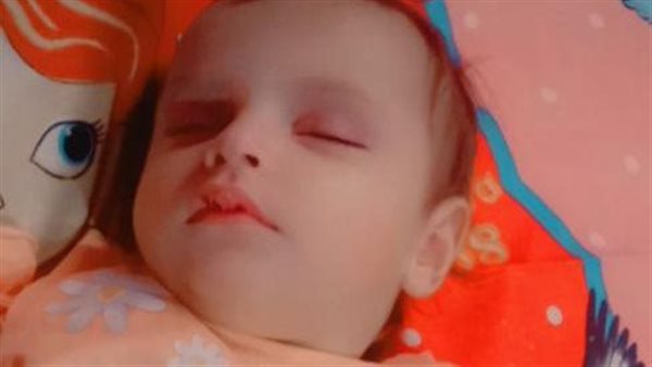 الطفلة رودينا