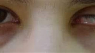 شاب من ذوي الهمم: نفسي في كشك أصرف بيه على نفسي