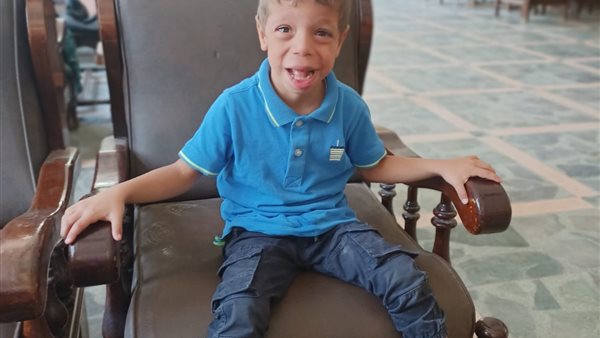 الطفل المصاب بمتلازمة