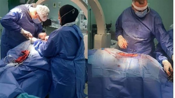 إجراء عملية تثبيت