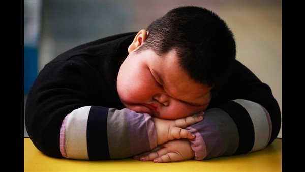 سمنة الأطفال