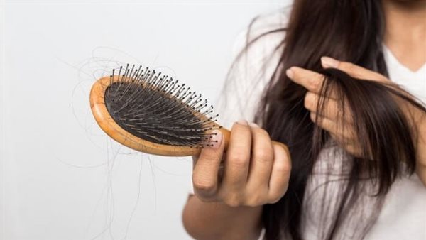 تساقط الشعر 