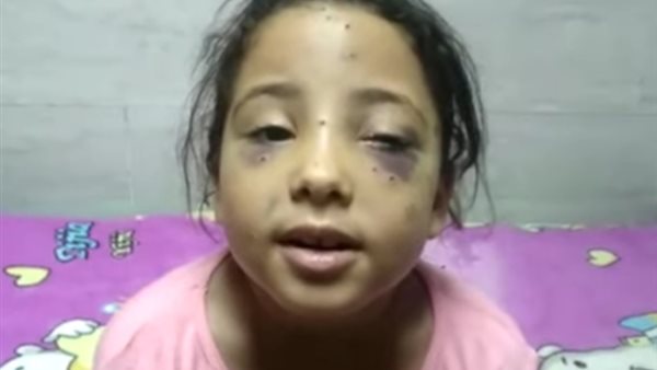 جومانا طارق المصابة