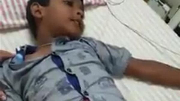 طفل مصاب بداء الكلب