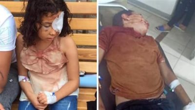 عم الطفلة المصابة بطلق ناري في الخانكة: أصيبت بالعمى وعايزين حقها