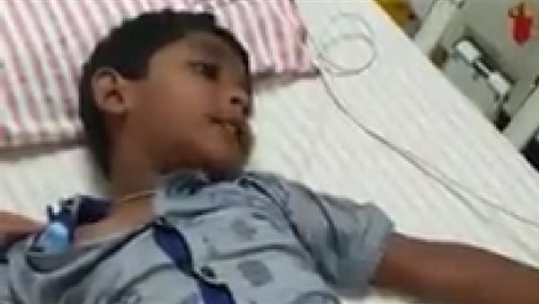 طفل مصاب بالسعار