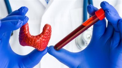 علامات تدل على نقص اليود بالجسم.. تعرف عليها