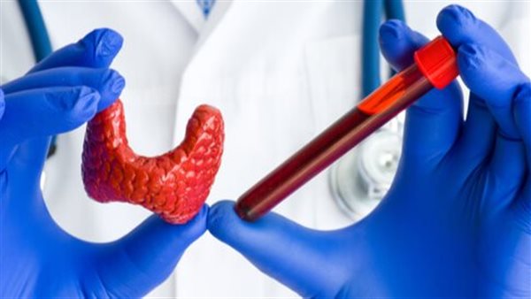 نقص اليود في الجسم