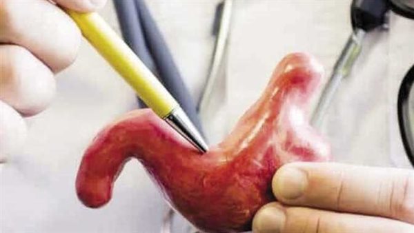 عمليات تكميم المعدة