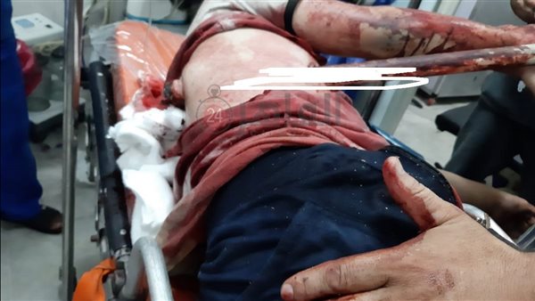 الماسورة في صدر الشاب