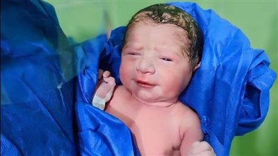 مصابة بـ كورونا تستقبل مولودها بمستشفى حجر كفر الدوار | صور