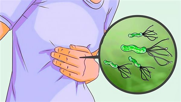 جرثومة المعدة