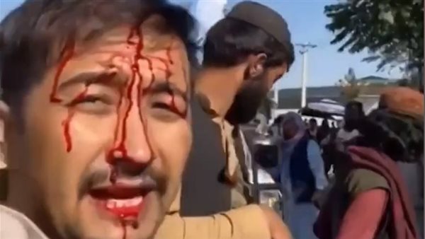 مواطن أسترالي يتعرض