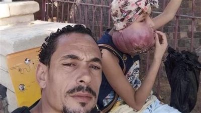 بنتي بتموت يا ريس.. أب يستغيث لعلاج ابنته المصابة بورم في الحلق