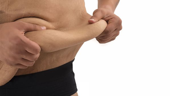 الجلد المترهل