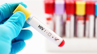 3 أشخاص فقط حول العالم.. شفاء أمريكية من فيروس الإيدز بعد علاجها بالخلايا الجذعية