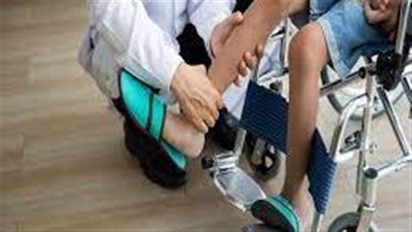 مرضى الضمور العضلي