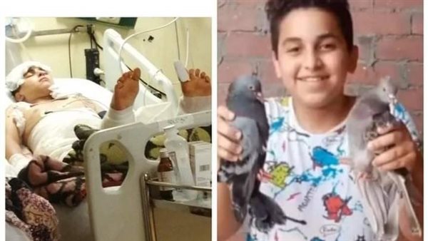 الطفل أحمد المصاب