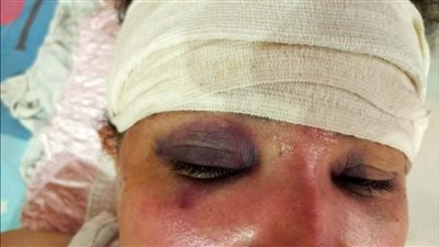 الداخلية تعلن القبض علي سفاح النساء ببورسعيد: مختل نفسيًا وله معلومات جنائية 