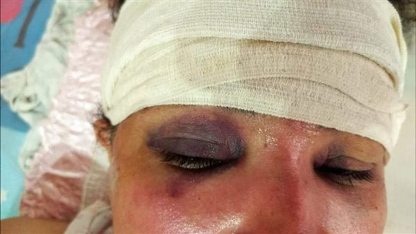 أحد السيدات المصابات