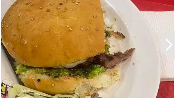 الإصبع داخل الهمبرجر