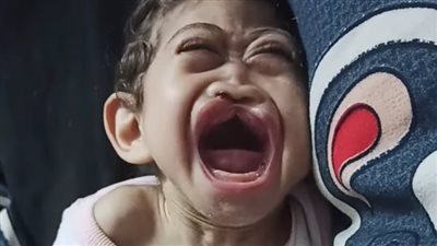 مودة تبحث عن العلاج من تشنجات مستمرة.. والأب يستغيث: صرفت كل فلوسي وعاوز أوصل للرئيس