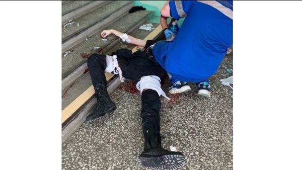 صورة للمهاجم بعد