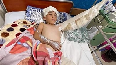 فقد ذراعه بسبب محوّل كهرباء عشوائي.. عم طفل بالشرقية يستغيث بالمسؤولين: معاذ دفع ضريبة الإهمال 