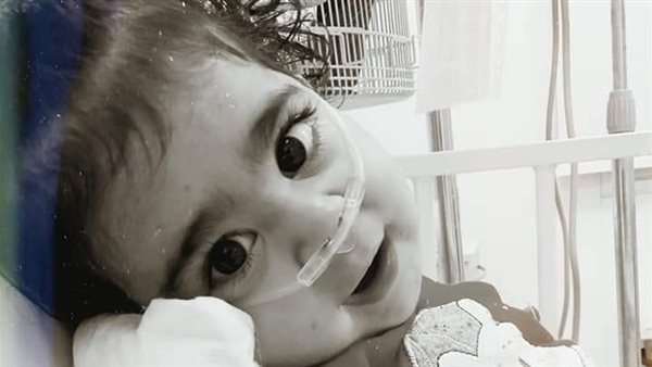 طفلة الضمور 