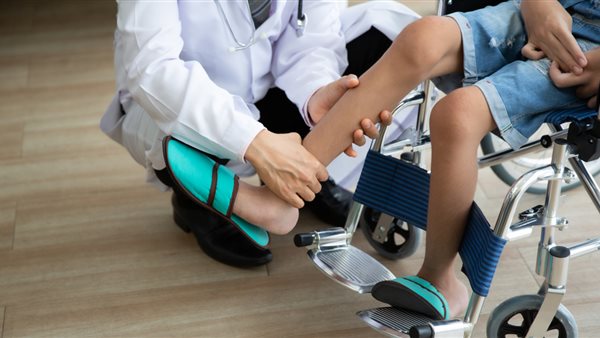 الضمور العضلي 