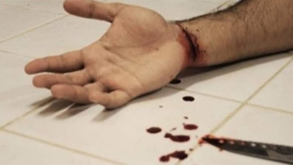 قطع شرايين اليد-أرشيفية