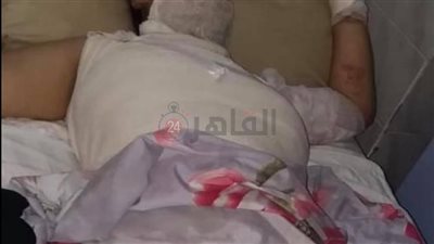حبس رجل أشعل النيران بـ ابنته في كفر الشيخ