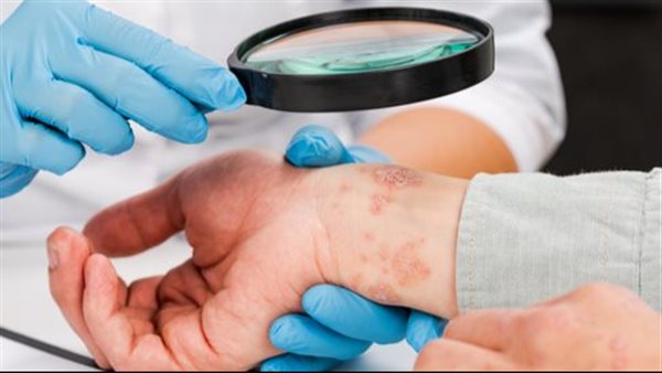 أمراض جلدية