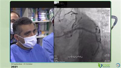 استشاري القلب بهيئة الرعاية الصحية ينجح في علاج مريض بالقسطرة القلبية في مؤتمر طبي بإسطنبول