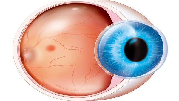 التبرع بالقرنية