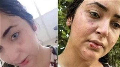 لعدم ارتدائها الحجاب.. ضرب وسحل صيدلانية بالشرقية