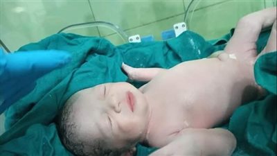 ولادة قيصرية لمصابة بـ كورونا في حجر مستشفى كفر الدوار │ صور