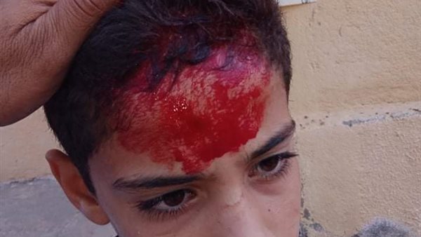 إصابة طالب سقطت عليه