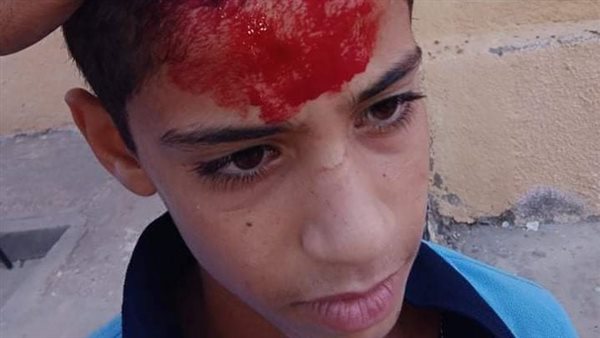 إصاب طالب بالمدرسة