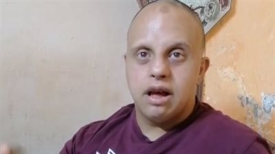 نفسي أتعالج وعاوز شقة علشان أتجوز.. شاب بالسويس يناشد المسئولين لعلاجه من متلازمة قدم الفيل