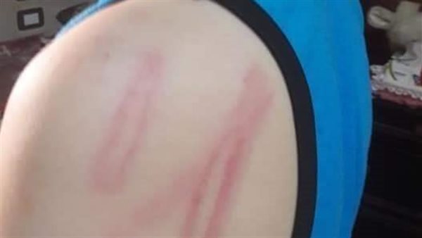 آثار التعذبب