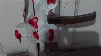 غلق غرفة العمليات وقسمي الأشعة والحضانات بمستشفى شهير في الغربية 