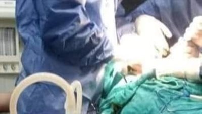 استغرقت 4 ساعات.. شفط 4 لترات صديد من بطن مريض بمستشفى الدلنجات | صور